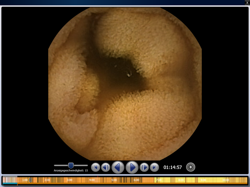 Bild einer Kapsel mittels Endoskopie